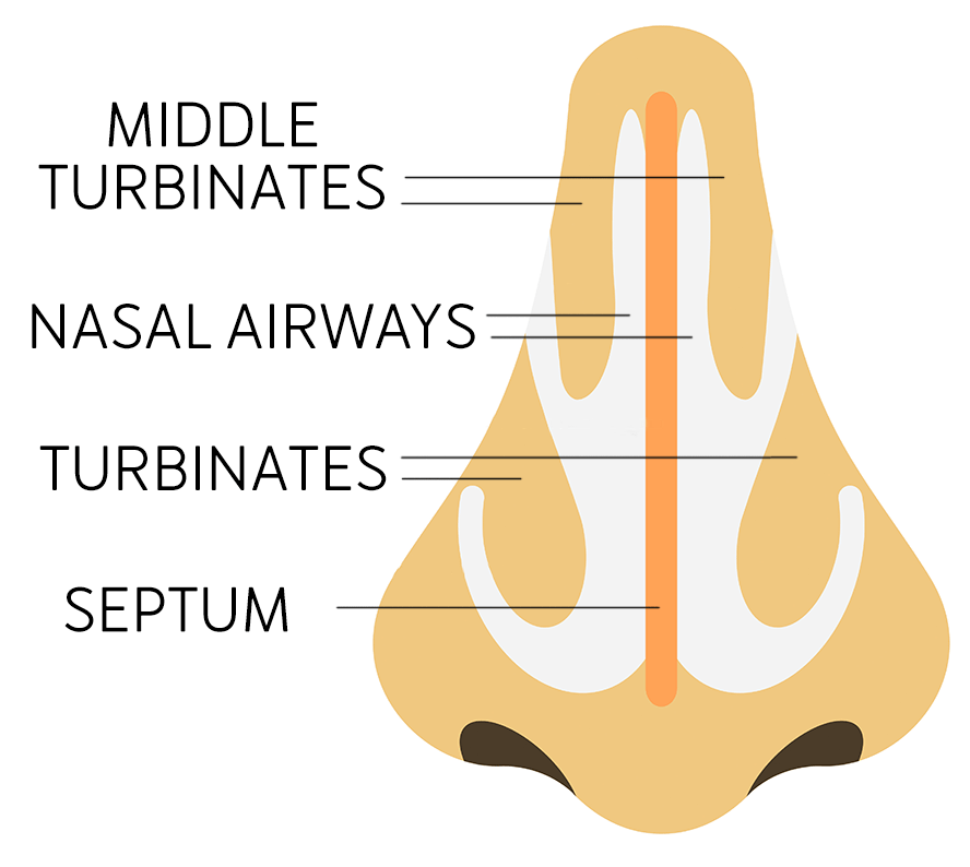 Nasal Valve Insufficiency Collapse West Coast Face